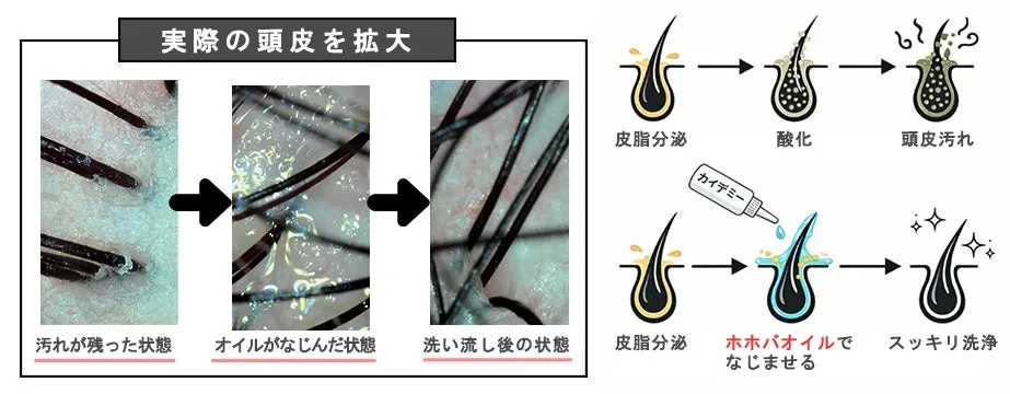 実際の頭皮の汚れがオイルで浮き上がる様子の拡大写真