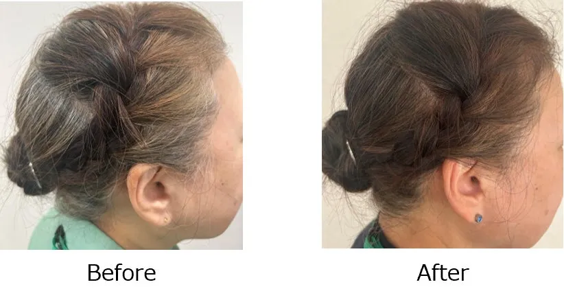 白髪染め使用前後のBefore/After比較写真